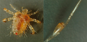 À propos des poux du pubis et de leur traitement avec des médicaments modernes