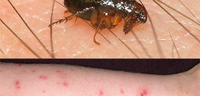 Les puces des chats et des chiens peuvent-elles être transmises à l'homme ?