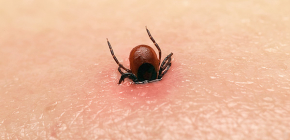 Premiers secours pour une piqûre de tique chez l'homme