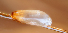 Lentes chez l'homme: photographies, caractéristiques du développement et méthodes de lutte