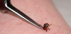 Période d'incubation de l'encéphalite à tiques chez l'homme