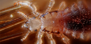 À quoi peuvent rêver les poux