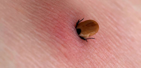 Comment enlever une tique coincée de la peau