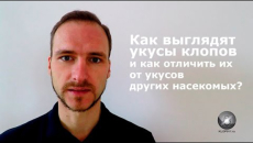 Voyons à quoi ressemblent les piqûres de punaises de lit et comment les distinguer des piqûres d'autres insectes.