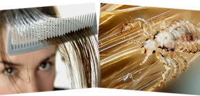 Pourquoi rêver de poux sur la tête et les cheveux