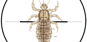 Aperçu des médicaments et des préparations pour éliminer les poux et les lentes