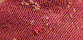 Poux de corps: caractéristiques de leur apparence et de leur mode de vie