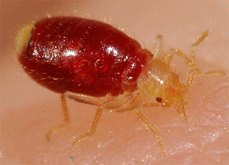 Piqûre de punaise de lit