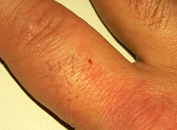 Larve de punaise de lit