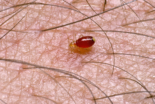 Larve de punaise de lit