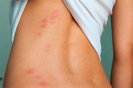 Trajectoire caractéristique des morsures