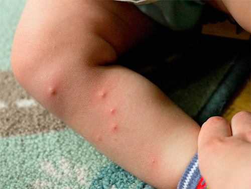 Une autre photo avec des piqûres de puces