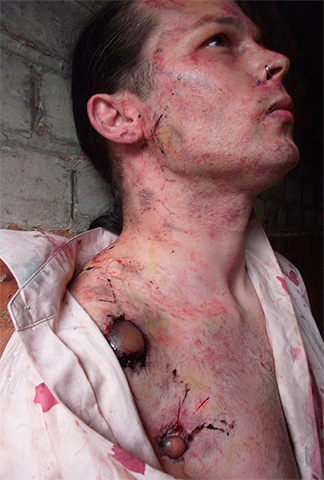 Les puces du rat sont porteuses de la peste bubonique