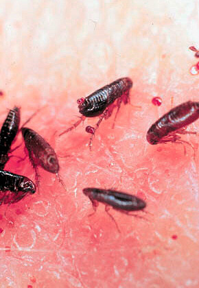 La plupart des piqûres de puces ne nécessitent pas de traitement.