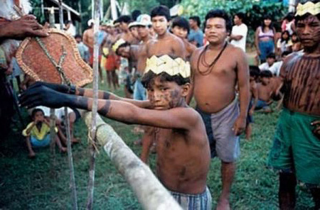 Après avoir été mordue par des fourmis, les mains d'une personne peuvent devenir noires.