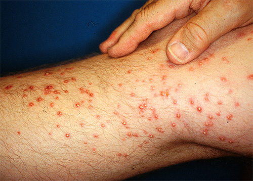 Leurs morsures sont très douloureuses.