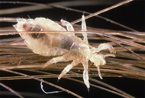 Sur la photo - un pou de tête dans les cheveux
