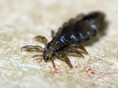 Les poux noirs dans un rêve peuvent laisser présager des problèmes ou des maladies chez les êtres chers.