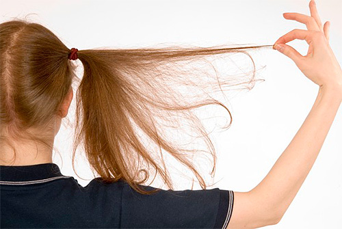 Interprétation des rêves Tsvetkova recommande de s'abstenir d'entreprises risquées si vous rêviez de poux sur votre tête ou sur votre corps