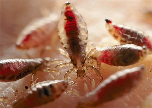 Regardons comment les poux peuvent être transmis à l'homme