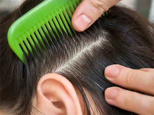 Les foules favorisent la transmission des poux de tête (à la fois les poux de tête et les poux de lin)