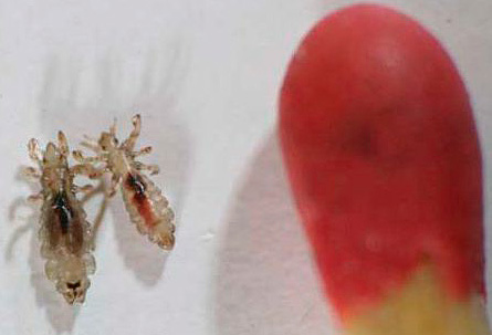 Les poux de tête et du pubis peuvent être transmis par contact sexuel.