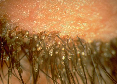 Une autre photo avec des lentes sur les cils