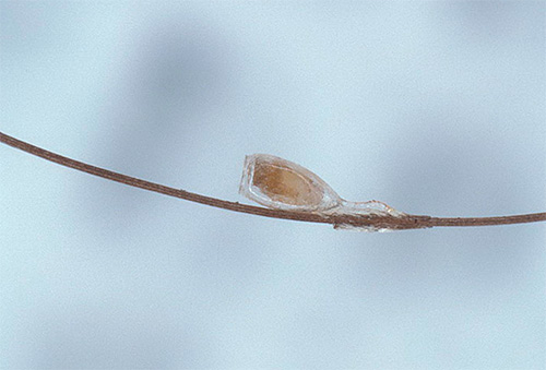 La photo montre que les lentes sont fermement collées aux cheveux.