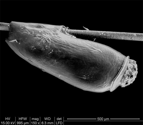 Voici à quoi ressemble une lente au microscope électronique