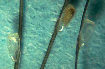 Lentes sur les cheveux (photo en gros plan)