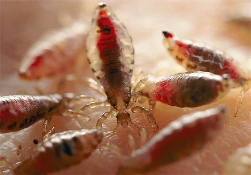 Que faire si vous vous trouvez ou votre enfant a des poux ? La réponse est simple : se faire soigner et le plus tôt possible !