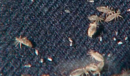 Poux de lin dans les vêtements