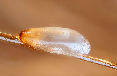 photo de lentes sur les cheveux