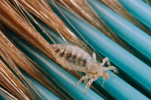 Partager des peignes, des épingles à cheveux et des élastiques à cheveux avec des enfants conduit souvent à une infestation de poux