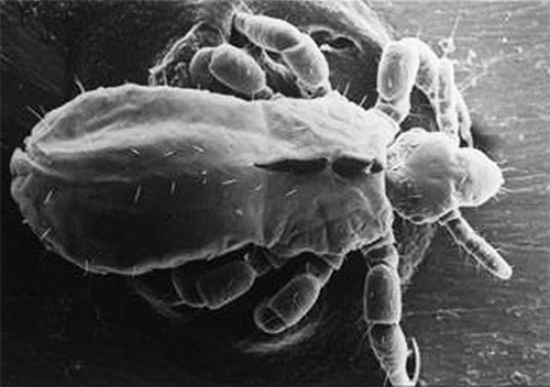 Photographie de poux de lit au microscope électronique
