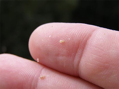 Pou de lit et ses lentes (œuf)