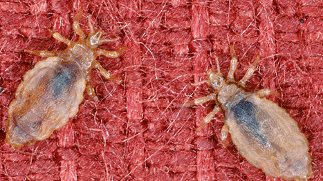 Les poux de corps vivent sur les vêtements, mais se nourrissent uniquement de sang humain.