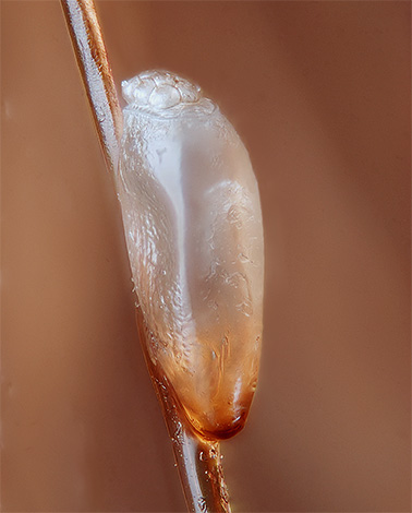 Poux lente sur les cheveux