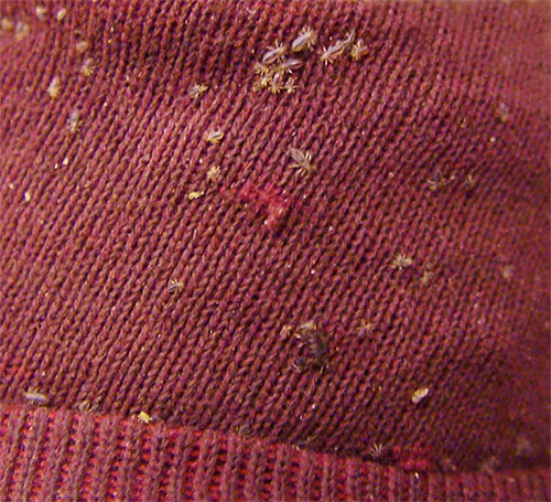 Le pou de corps vit sur les vêtements, qui peuvent devenir une source d'infection.