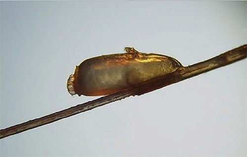 Les poux attachent leurs œufs (lentes) aux cheveux