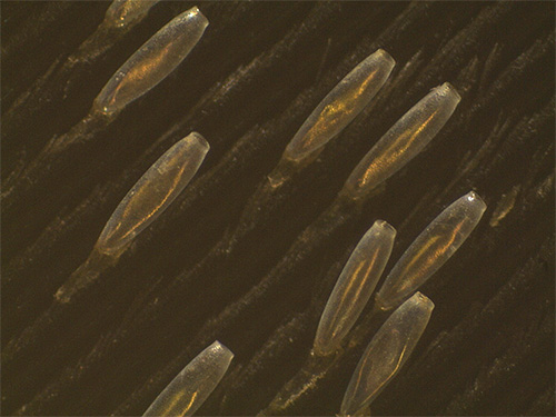 Les lentes des poux de corps sont attachées aux villosités du tissu