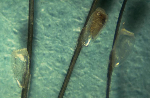 La forte fixation des lentes aux cheveux peut être desserrée avec du kérosène