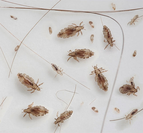 En cas de pédiculose sévère, le traitement avec Para Plus et le peignage avec un peigne doivent être répétés plusieurs fois