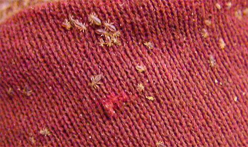 Considérez à quoi ressemblent les poux de corps et leurs piqûres, ainsi que la façon de traiter ces parasites.