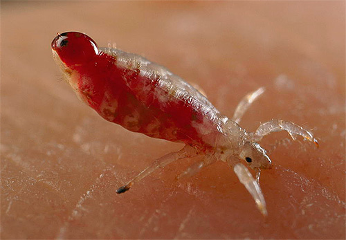 Photographie de poux de corps au microscope