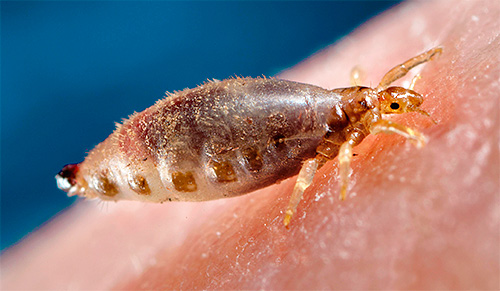 Une autre photo d'un pou de corps buvant du sang