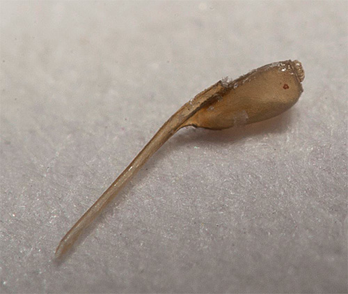 Enlever les lentes des cheveux est souvent plus difficile que les poux eux-mêmes.