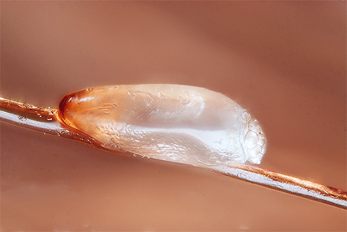 La photo montre une lente fermement attachée aux cheveux.