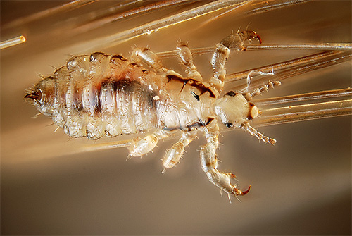 poux sur les cheveux