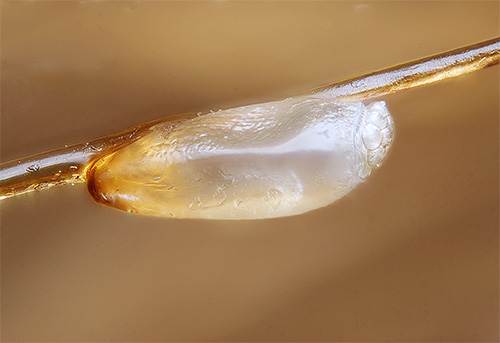 Sur la photo - une lente de pou de tête, fermement attachée aux cheveux